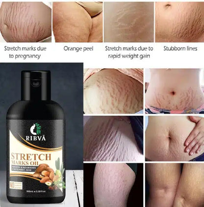 Ribva Stretch Care Oil (50 ml)